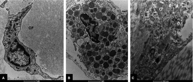 Microscopie du tissu fascial humain — fibres de collagène et fibroblastes